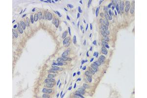 Immunohistochemistry analysis of paraffin-embedded human gallbladder using FAS Monoclonal Antibody at dilution of 1:200. (FAS anticorps)