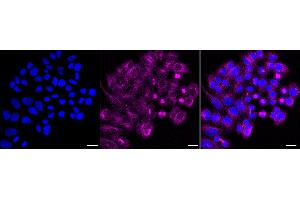 Immunocytochemical staining of HepG2 cells with GABRA5 antibody (ABIN7798689), 1:).