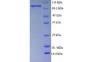 SDS-PAGE (SDS) image for Desmoglein 3 (DSG3) (AA 50-615) protein (His-SUMO Tag) (ABIN5709421)