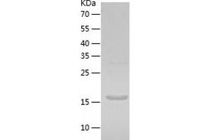 Western Blotting (WB) image for RAN Binding Protein 1 (RANBP1) (AA 1-201) protein (His-IF2DI Tag) (ABIN7124773)