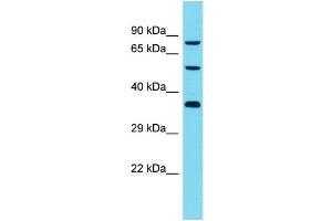 Host: Rabbit Target Name: DCAF8L2 Sample Type: Jurkat Whole Cell lysates Antibody Dilution: 1. (DCAF8L2 anticorps  (C-Term))