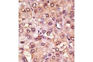 Image no. 2 for anti-Achaete-Scute Complex Homolog 1 (Drosophila) (ASCL1) (C-Term) antibody (ABIN357401)