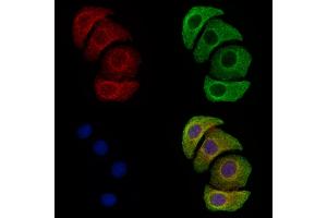 ABIN6255764 and ABIN6274056 staining Hela cells(4h of LPS treatment) by IF/ICC. (PKM2 anticorps  (pTyr105))