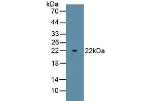 Detection of Recombinant ATP1a1 using Polyclonal Antibody to ATPase, Na+/K+ Transporting Alpha 1 Polypeptide (ATP1a1) (ATP1A1 anticorps)