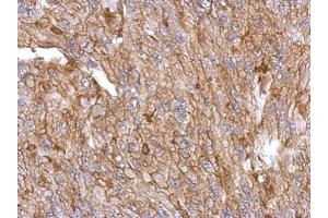 IHC-P Image Immunohistochemical analysis of paraffin-embedded U87 xenograft, using Annexin III, antibody at 1:500 dilution. (Annexin A3 anticorps)