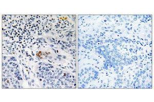 Immunohistochemistry (IHC) image for anti-Zinc Finger and BTB Domain Containing 40 (ZBTB40) (C-Term) antibody (ABIN1852400) (ZBTB40 anticorps  (C-Term))