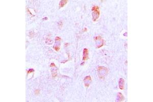 Immunohistochemical analysis of BCL2 staining in human brain formalin fixed paraffin embedded tissue section. (Bcl-2 anticorps  (Center))