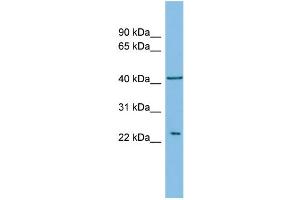 WB Suggested Anti-RALB Antibody Titration: 0. (RALB anticorps  (Middle Region))