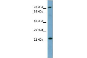 KRAS antibody used at 1 ug/ml to detect target protein. (K-RAS anticorps  (N-Term))