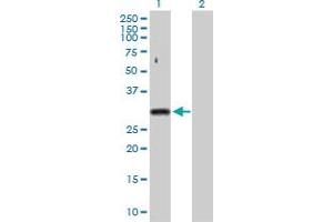 Western Blot analysis of SNRPA expression in transfected 293T cell line by SNRPA MaxPab polyclonal antibody. (SNRPA1 anticorps  (AA 1-282))