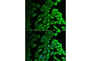 Immunofluorescence analysis of A549 cell using IL18BP antibody. (IL18BP anticorps)