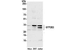 anti-General Transcription Factor IIE, Polypeptide 2 (GTF2E2) (AA 241-291) antibody