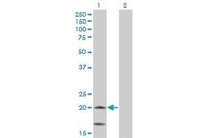 Western Blot analysis of NDUFS4 expression in transfected 293T cell line by NDUFS4 monoclonal antibody (M01A), clone 1A1. (NDUFS4 anticorps  (AA 66-175))