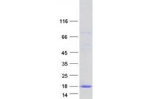 Validation with Western Blot