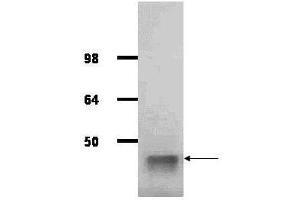 IgG purified antibody to rabbit muscle aldolase (100-1141, 200-1141 and 200-1341) was used at a 1:1000 dilution to detect human aldolase by western blot.