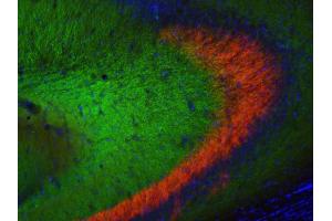 Indirect immunohistochemistry of a mouse hippocampus section with anti ZnT-3 (dilution 1 : 250; red) and anti-MAP2 (Cat.