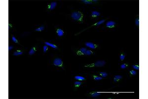 Immunofluorescence of purified MaxPab antibody to GOLM1 on HeLa cell. (GOLM1 anticorps  (AA 1-401))