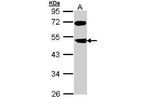 WB Image Sample (30 ug of whole cell lysate) A: Molt-4 , 10% SDS PAGE antibody diluted at 1:1000 (FBXL3 anticorps)