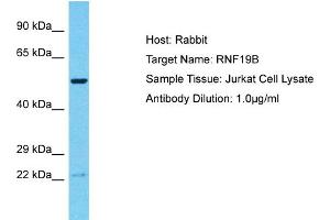 Host: Rabbit Target Name: RNF19B Sample Tissue: Human Jurkat Whole Cell Antibody Dilution: 1ug/ml