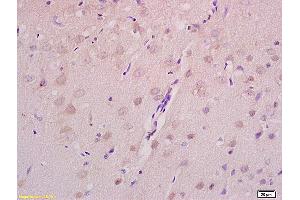 Formalin-fixed and paraffin embedded rat brain tissue labeled with Anti Axin 2 Polyclonal Antibody,Unconjugated (ABIN713696) at 1:200 followed by conjugation to the secondary antibody and DAB staining. (AXIN2 anticorps  (AA 331-430))