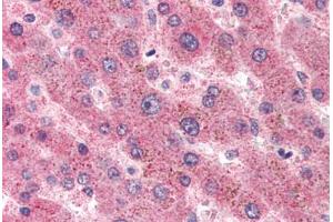 Human Liver (formalin-fixed, paraffin-embedded) stained with SAA1 antibody ABIN305908 at 5 ug/ml followed by biotinylated anti-mouse IgG secondary antibody ABIN481714, alkaline phosphatase-streptavidin and chromogen.