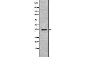 Western blot analysis GS28 using K562 whole cell lysates (GS28 anticorps  (Internal Region))