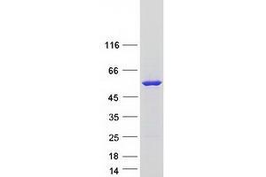 Validation with Western Blot (FMO3 Protein (Transcript Variant 2) (Myc-DYKDDDDK Tag))