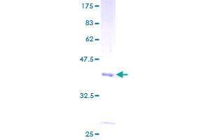 SDS-PAGE (SDS) image for Churchill Domain Containing 1 (CHURC1) (AA 1-112) protein (GST tag) (ABIN1349454)