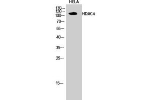 Western Blotting (WB) image for anti-Histone Deacetylase 4 (HDAC4) (Ser632) antibody (ABIN5956852) (HDAC4 anticorps  (Ser632))