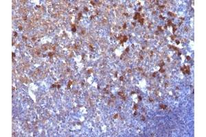 Formalin-fixed, paraffin-embedded human tonsil stained with IgG antibody (IG217) (Souris anti-Humain IgG Anticorps)