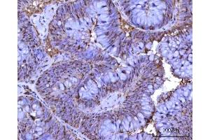 IHC analysis of RRP1 using anti-RRP1 antibody (ABIN7600683). (RRP1 anticorps  (AA 22-237))