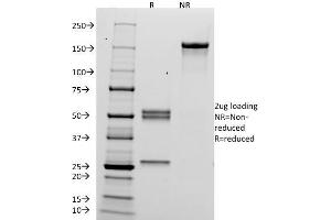SDS-PAGE Analysis Purified hCG alpha Mouse Monoclonal Antibody (HCGa/53). (CGA anticorps)
