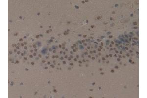 IHC-P analysis of Rat Brain Tissue, with DAB staining. (Cytokeratin 1 anticorps  (AA 489-625))