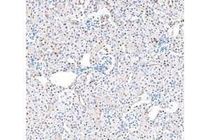 IHC analysis of ADK using anti-ADK antibody (ABIN4886430). (ADK anticorps  (AA 165-351))