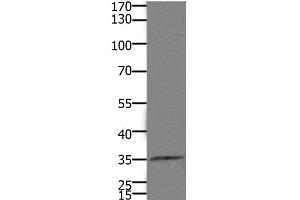 Western Blot analysis of Mouse kidney tissue using HOXD11 Polyclonal Antibody at dilution of 1:1100 (HOXD11 anticorps)