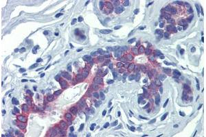 Breast, Human: Formalin-Fixed, Paraffin-Embedded (FFPE)