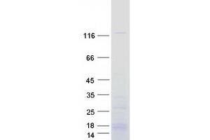 Validation with Western Blot