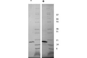 SDS-PAGE of Human Fibroblast Growth Factor-22 Recombinant Protein SDS-PAGE of Human Fibroblast Growth Factor-22 Recombinant Protein. (FGF22 Protéine)