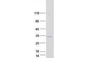 Validation with Western Blot