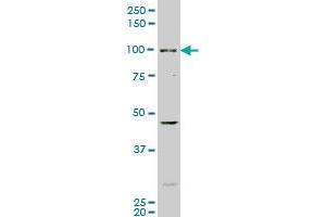 AHR monoclonal antibody (M02), clone 3B12 Western Blot analysis of AHR expression in COLO 320 HSR