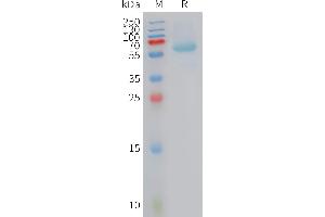 Human BAMBI Protein, hFc Tag on SDS-PAGE under reducing condition.