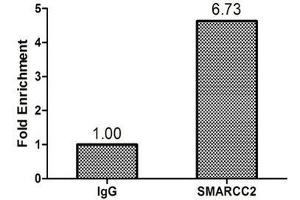 Chromatin Immunoprecipitation Hela (1.