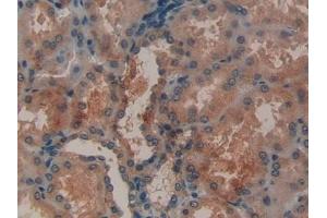 Detection of MMP12 in Human Kidney Tissue using Polyclonal Antibody to Matrix Metalloproteinase 12 (MMP12)