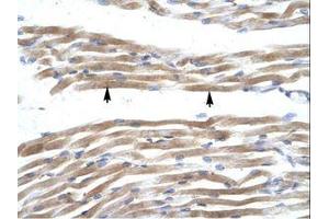 Image no. 1 for anti-Fatty Acid Binding Protein 3, Muscle and Heart (FABP3) (AA 46-95) antibody (ABIN202026) (FABP3 anticorps  (AA 46-95))