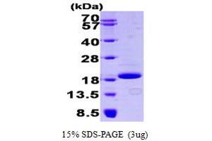 SDS-PAGE (SDS) image for Eukaryotic Translation Initiation Factor 4E Binding Protein 1 (EIF4EBP1) (AA 1-118) protein (His tag) (ABIN666658)