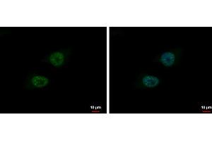 ICC/IF Image BLM antibody [N1N2], N-term detects BLM protein at nucleus by immunofluorescent analysis. (BLM anticorps  (N-Term))