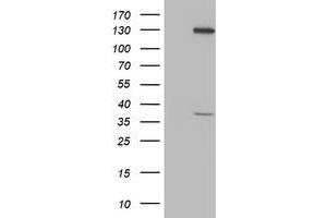 Image no. 3 for anti-PIH1 Domain Containing 2 (PIH1D2) (AA 1-315) antibody (ABIN1490740)