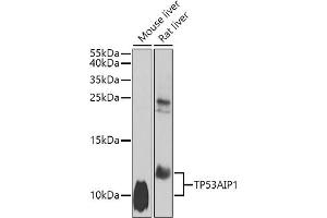 Western blot analysis of extracts of various cell lines, using TP53 antibody (ABIN6130605, ABIN6149411, ABIN6149413 and ABIN6223058) at 1:1000 dilution. (TP53AIP1 anticorps  (AA 1-108))