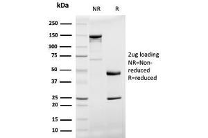 SDS-PAGE Analysis Purified Prohibitin Mouse Monoclonal Antibody (PHB/3194).