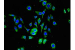 Immunofluorescent analysis of PC-3 cells using ABIN7169873 at dilution of 1:100 and Alexa Fluor 488-congugated AffiniPure Goat Anti-Rabbit IgG(H+L) (SNRPD1 anticorps  (AA 1-119))